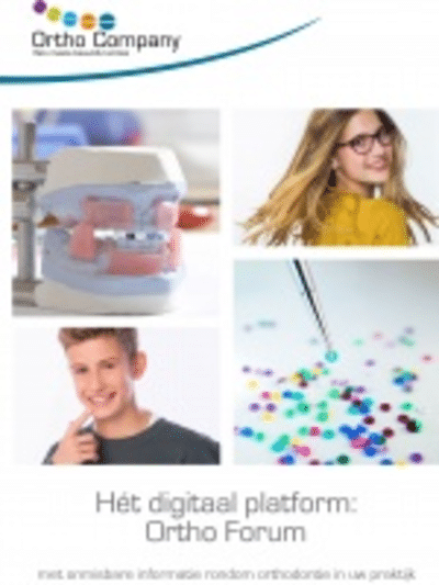 Wilt u een carriere motion appliance kopen?